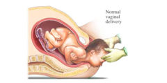 اعراض الولاده الطبيعيه علامات المخاض والاستعدادات الواجبة