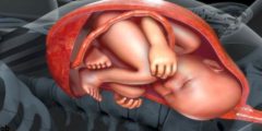غشاء الجنين الذي يخرج معه عند الولادة ماذا يسمي