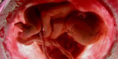 ما هي اسباب حركة الجنين في الشهر السادس اسفل البطن! وما دلالتها؟