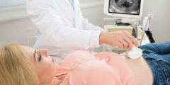 ما الأسباب الطبية في توقف حركة الجنين في الشهر السادس ؟ وهل يدل ذلك على اجهاض الجنين؟