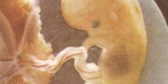 تعرف على مراحل نمو الجنين في القران الكريم