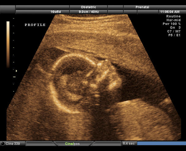حركة الجنين في الشهر السابع اسفل البطن