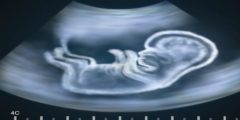 اعراض الوحم عند الحامل بولد ونوع الجنين
