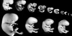 كيف هي مراحل الحمل شهر بشهر بالصور