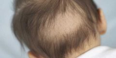 اسباب تساقط الشعر عند الاطفال وطرق العلاج
