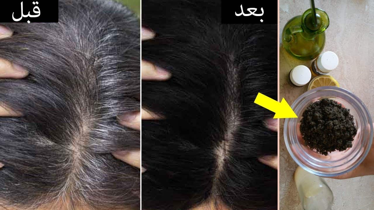 طريقة علاج شيب الشعر