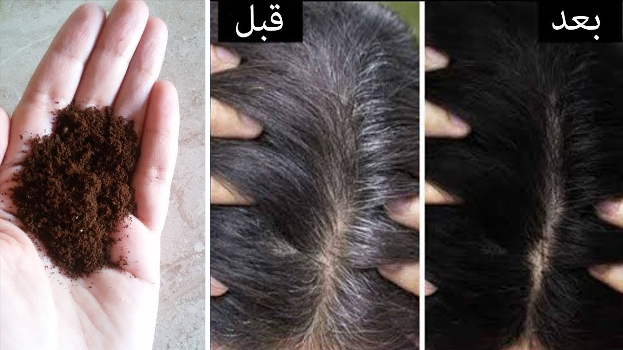 طريقة علاج شيب الشعر