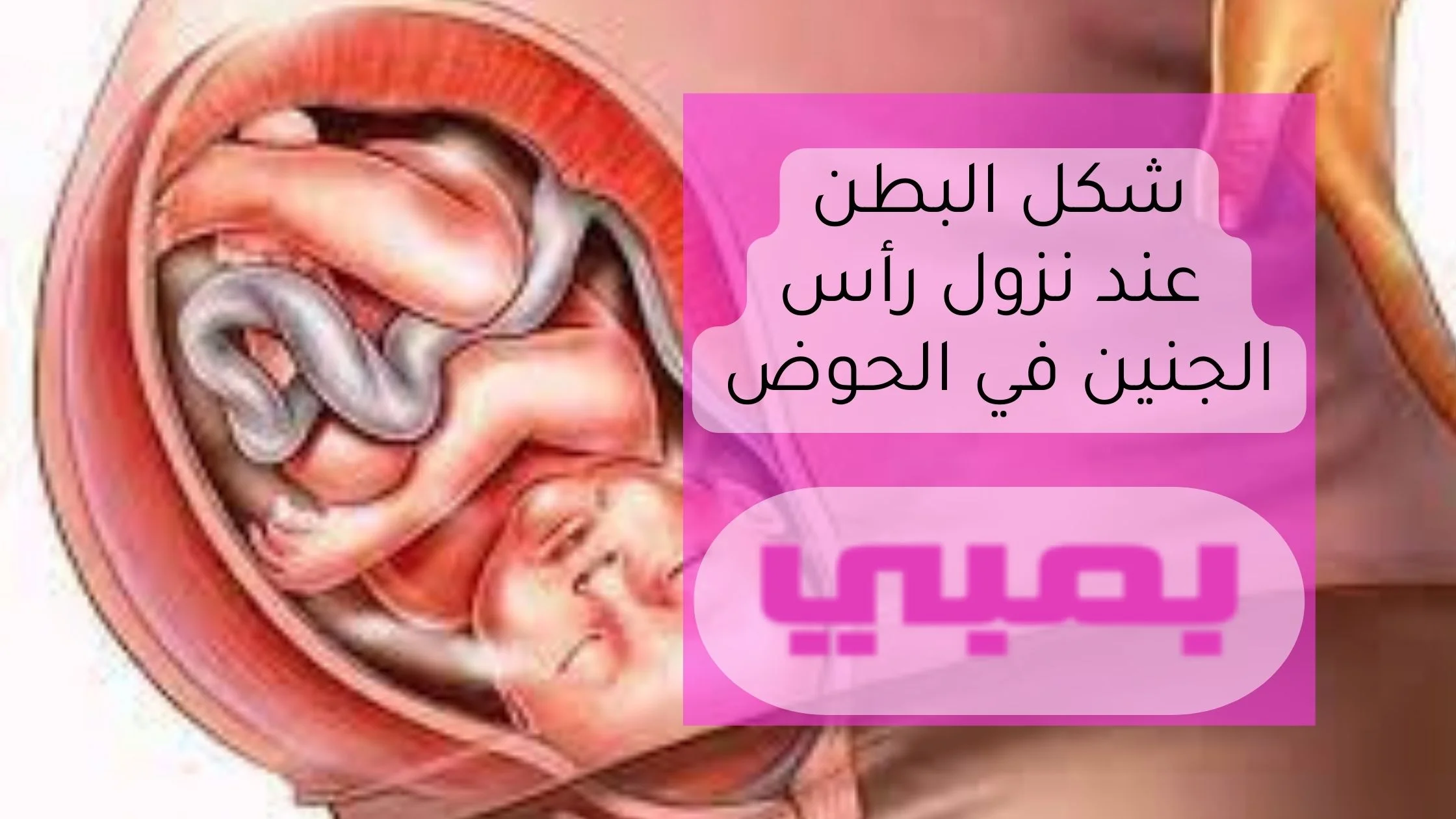 تأثير شكل البطن عند نزول رأس الجنين في الحوض على الولادة